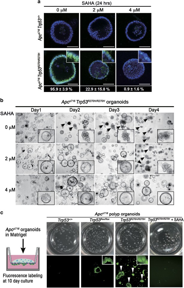 Confocal and organoid microscopy showing mutant-p53 tumour morphology and invasion after therapeutic perturbation. Figure 4, Oncogene (2017). Reused unchanged under CC BY 4.0.