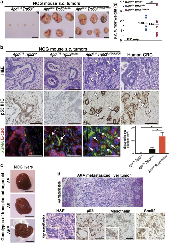 Histology, p53 immunohistochemistry and fluorescence microscopy illustrating mutant-p53 tumour progression, altered gland architecture and invasive behaviour. Figure 5, Oncogene (2017). Reused unchanged under CC BY 4.0.